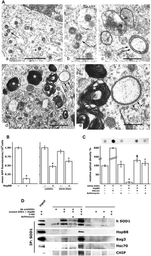 HspB8对运动神经元NSC34细胞自噬标记物积累的影响。（A） 转染G93A-SOD1和HspB8（A–c）的NSC34细胞和tg G93A-SOD1小鼠ES（d和e）腰椎脊髓切片中自噬结构的超微结构检测。NSC34双转染细胞的细胞质中含有几个大小不同的囊泡，囊泡被双层膜包围（箭头所示）；Nu，细胞核。比例尺=0.5µm in（a）和（c）；0.2µm英寸（b）。ES tg G93A-SOD1小鼠神经元剖面的细胞质包含由双膜（箭头）包围的空泡，双膜分散在电子致密物质聚集体和膜样结构轮回（星号）中。比例尺=2µm in（d）；1µm英寸（e）。（B） 对表达GFP-LC3和wtSOD1或突变G93A-SOD1的NSC34细胞进行流式细胞荧光分析。使用10 nm的巴非霉素在APLP条件下同步细胞15 h，在分析前3 h将其去除（模拟与模拟+HspB8，wtSOD1与wtSOD1+HspB8，*P<0.001；G93A-SOD1对G93A-SOD1+HspB 8，°P<0.01）。（C） 在没有或存在HspB8的情况下，在基础条件下或用10µm MG132治疗24小时或用10 nm Bafilomycin治疗24小时后，对表达突变GFP-G93A-SOD1的NSC34细胞进行过滤延迟分析。直方图表示过滤延迟分析的量化（来自三个不同的重复）（*P<0.001，+HspB8 vs.−HspB8.§P<0.001+Mg132+HspB8 vs.+Mg132；°P<0.001,+HspB 8+bafilo vs.+HspB38）。（D） 自噬阻断期间永生化运动神经元中突变SOD1s和HspB8相互作用的分析。在HspB8存在的情况下，对从未转染的NSC34或表达突变G93A-SOD1的NSC34SOD1获得的SOD1免疫沉淀样品进行Western blot分析。随后使用抗SOD1抗体进行印迹处理，并使用识别转染HspB8、抗Bag3抗体、抗Hsc70抗体和最终抗CHIP抗体（抗Bag2、Hsc70和CHIP抗体识别内源性小鼠蛋白）的抗c-myc抗体进行剥离处理。用10mm 3-MA处理24小时或用10nm巴非霉素处理24小时。在基础条件下，突变SOD1的免疫沉淀样品中似乎存在一条微弱的HspB8带。用3-MA抑制自噬体形成，导致已知通过自噬介导HspB8作用的复合物的急剧积累：HspB8-Bag3-Hsc70-CHIP。