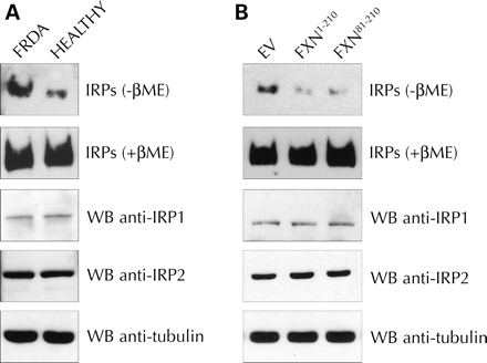 线粒体外frataxin抑制IRP1 RNA结合活性。（A） 将FRDA患者（FRDA）和健康对照淋巴母细胞（健康）的细胞提取物与IRE RNA探针孵育，加入或不加入能充分激活IRP1-结合能力的3%β-巯基乙醇（βME），并通过6%的天然聚丙烯酰胺凝胶电泳分析IRP带移。通过western blotting分析相同提取物的IRP1和IRP2表达水平。（B） 对用EV、FXN1–210或线粒体外FXN81–210稳定重组的患者淋巴母细胞的细胞提取物进行IRP带移位和IRP蛋白水平分析，如（A）所示。