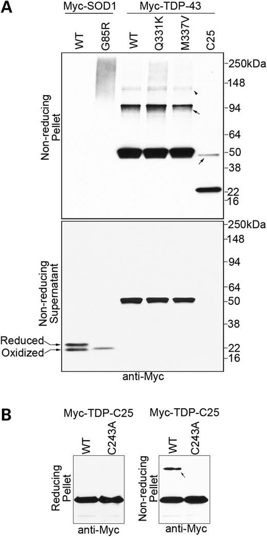 TDP-43 protein dimers and oligomers linked by disulfide bonds are enriched in aggregates in vivo. (A) N-terminal Myc-tagged TDP-43 and SOD1 variants were transfected into HEK293T cells, and the lysates were detergent extracted in the presence of the thiol blocker iodoacetamide. The insoluble pellet and the soluble supernatant fractions were both analyzed with denaturing and non-reducing SDS–PAGE without β-mercaptoethanol. The top panel shows the pellet fraction in which the aggregated protein was enriched. In contrast to mutant SOD1 G85R, which is ‘glued’ together by disulfide bonds into large aggregates, distinct TDP-43 dimers (arrows) and oligomers (arrowhead) dependent on β-mercaptoethanol are observed. The bottom panel shows the supernatant fraction, in which the majority of soluble TDP-43 or SOD1 proteins are not disulfide cross-linked. The doublet bands of WT SOD1 are due to its intramolecular disulfide bond. A fraction of soluble WT SOD1 protein was disulfide-reduced and subsequently modified by iodoacetamide, resulting in a slower migration, as described previously (68). The soluble SOD1 G85R protein has a characteristic faster migration than WT SOD1 and is presumably all in a reduced state. (B) Mutating the only cysteine in TDP-C25 (C243A) blocked the formation of the insoluble dimers (arrow), but the aggregation of the majority of the protein was not significantly affected.