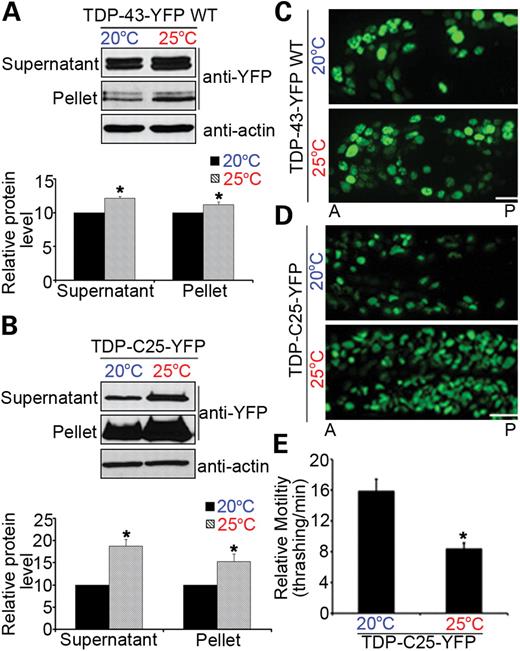 Elevated environmental temperature increases protein aggregation and neurotoxicity in transgenic TDP-43 C. elegans. Both WT TDP-43-YFP (A) and TDP-C25-YFP (B) proteins show increased accumulation in soluble and insoluble fractions at 25°C when compared with those at 20°C (*P < 0.05; n = 3). Ten micrograms (∼1/20) of soluble supernatant protein and 5 µg (∼1/4) of insoluble pellet protein were analyzed by immunoblotting. (C) Elevated temperature increases the accumulation of WT TDP-43-YFP in C. elegans neurons. Anterior (A) and posterior (P) regions of heads of L4 animals are shown. (D) Aggregates of TDP-C25-YFP are markedly increased in number and size in response to the elevated temperature. Head neurons of L1 animals are shown. (E) Quantitation of the effects of temperature elevation on the locomotor behavior of 1-day adult TDP-C25-YFP animals (*P < 0.05). n = 32, error bars represent the SEM. Scale bars: 5 µm.