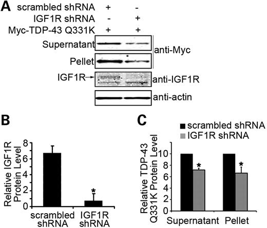 Reduction in the function of insulin/IGF1R suppresses the aggregation of TDP-43 in human cells. (A) Knockdown of IGF1R by shRNA in HEK293T cells decreases the accumulation of soluble and insoluble aggregated Myc-TDP-43 Q331K. Twelve micrograms (∼1/50) of soluble supernatant protein and 15 µg (∼1/10) of insoluble pellet protein were analyzed by immunoblotting with the anti-Myc antibody. (B) Quantitation of the knockdown of the IGF1R protein expression is shown. (C) Quantitation of soluble and insoluble Myc-TDP-43 Q331K protein levels after the knockdown of IGF1R. *P < 0.05, n = 3, error bars represent the SEM.