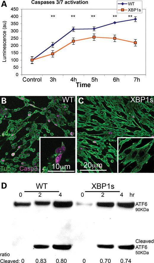 XBP1s prevents Aβ-dependent caspase activation, but not ER stress. (A) Temporal analysis of caspase-3 and -7 activation in WT and mXBP1s cells treated with Aβ oligomers at 18 µg/ml. (A) WT cells (blue diamonds) progressively accumulate activated caspases over the course of the experiment. In mXBP1s cells (orange squares), activated caspase levels peak at 5 h, then decrease in the last 2h (n= 3, **P< 0.01). (B and C) Distribution of activated (act)-caspase-3 in PC12 cells treated with oligomeric Aβ at 18 µg/ml. WT cells appear small and round, and accumulate act-caspase-3 (B), whereas mXBP1s cells preserve their morphology and accumulate very little act-caspase-3 (C). (D) Western blot shows ATF6 activation in WT and mXBP1s cells treated with a subtoxic dose of Aβ oligomers (9 µg/ml). After a 4 h incubation, both WT (0.83 ± 0.0075 and 0.8 ± 0.03) and mXBP1s cells (0.7 ± 0.026 and 0.74 ± 0.023) accumulate cleaved ATF6. After a 4 h incubation, both WT and mXBP1s cells accumulate cleaved ATF6. There is no significant difference in the ratio of cleaved ATF6 between WT and mXBP1s, although mXBP1s accumulated less-activated ATF6 in two different time points.