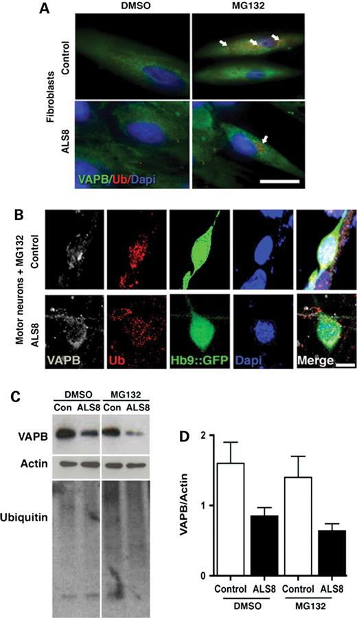MG132处理后的VAPB染色。（A） MG132处理的成纤维细胞增加了泛素点状染色的数量（箭头所示）。棒材=25µm。（B） MG132治疗后，对照组和ALS8-iPSCs衍生的Hb9:：GFP运动神经元的VAPB核周分布相似。棒材=10µm。（C） 二甲基亚砜或MG132处理后VAPB蛋白稳定性的western blot代表性数据。MG132通道中泛素染色较高表明蛋白酶体受到抑制。（D） 图表显示了两名个体对照组和两个家族的两名ALS8患者治疗后VAPB蛋白量的平均值。