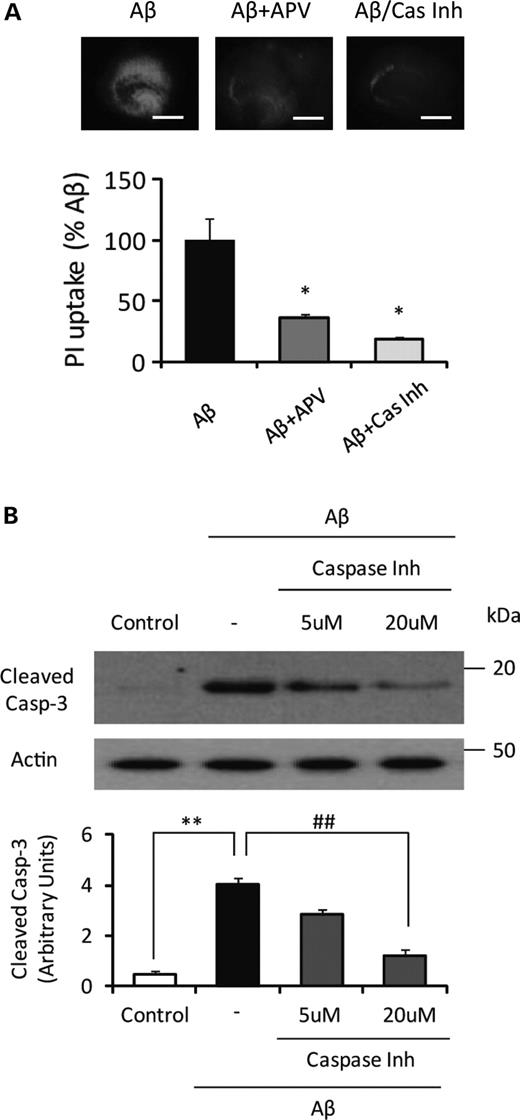 NMDA antagonist (APV) and caspsase inhibitor (Z-VAD-FMK) treatment significantly attenuate Aβ oligomer-induced PI uptake. (A) The slices were treated with Aβ1–42 oligomer (500 nm). APV (20 μm) or Z-VAD-FMK (Cas Inh) (20 μm) was co-applied with Aβ oligomer (n= 5). Both APV and Z-VAD-FMK dramatically reduced the level of PI uptake induced by Aβ1–42 oligomer. Scale bar, 500 μm (*P< 0.05 versus Aβ). (B) Pretreatment of caspase inhibitor, Z-VAD-FMK (20 μm), significantly reduced Aβ oligomer-induced caspase-3 activation (n= 3) (**P< 0.01 versus control, ##P< 0.01 versus non- inhibitor).