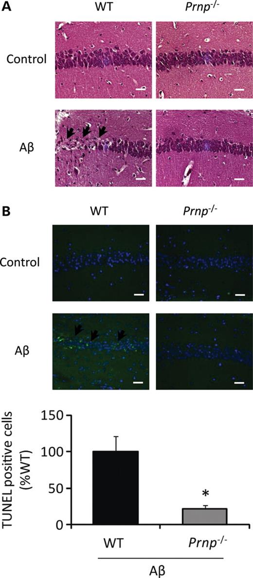 PrPC is essential for Aβ oligomer-induced neurotoxicity in vivo. (A) Prnp−/− and WT mice were sacrificed and brain tissues stained with H&E at 20 days after Aβ oligomer injection. Neuronal cell loss in hippocampus was evident in WT mice injected with Aβ oligomer (arrows) but not in Prnp−/− mice. Scale bar, 100 μm. (B) The number of TUNEL-positive cells (arrows) in hippocampus was dramatically reduced in Prnp−/− mice after Aβ oligomer injection compared with WT mice (n= 5). Scale bar, 100 μm (*P< 0.05).