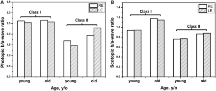 Scotopic and photopic ERG average b/a-wave ratios as a function of average patient age and severity of the XLRS phenotype. Average b/a-wave ratios obtained for patients divided into four groups by missense mutation classes (class I = mild, class II = severe) and by patient age (young and old) defined similarly to that shown in the Supplementary Material, Table S3 and presented in (A) and (B), respectively. ERG b/a-wave ratios for right and left eyes in each group are shown by open and shaded bars.