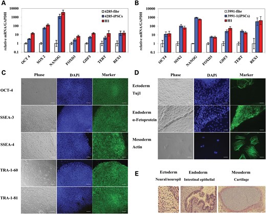 Characterization of HD and DM1 iPSCs. HD and DM1 iPSCs show similar expression of pluripotency genes as H1 hESCs. (A) HD (GM04285) fibroblasts, iPSCs and H1 hESCs. (B) DM1 (GM03991) fibroblasts, iPSCs (clone 1) and H1 hESCs. mRNA levels are normalized to GAPDH. Error bars indicate SEM of duplicate measurements. (C) Staining of pluripotency markers in DM1 (GM03991) iPSCs (clone 1). Phase contrast (gray); nuclear staining (blue); pluripotency markers staining (green). Tra-1-60 and Tra-1-81, surface markers; SSEA-3 and SSEA-4, stage-specific embryonic antigens; OCT4, transcription factor. Scale bars represent 0.1 mm. (D) Staining of three germ layer markers in DM1 (GM03991) iPSCs (clone 1) EB. Phase contrast (gray); nuclear staining (blue); three germ layer markers staining (green). Tuj1, ectoderm marker; a-Fetoprotein, endoderm marker; actin, mesoderm marker. Scale bars represent 0.05 mm. (E) Representative in vivo differentiation assay for assessing the pluripotency of HD iPSCs. Teratoma tissue sections were stained with hematoxylin and eosin and imaged by brightfield microscopy. Differentiated tissues representing ectoderm (neural/neuropil tissue), endoderm (intestinal epithelia) and mesoderm (cartilage) are shown.