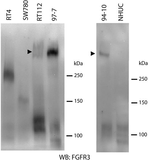 Non-denaturing gel showing the presence of constitutively dimerized S249C mutant protein in 94-10 and 97-7 cells which contain point mutant (S249C) FGFR3 but not in NHUC, RT4 or SW780. A small amount of the dimer is present in RT112 (arrow).
