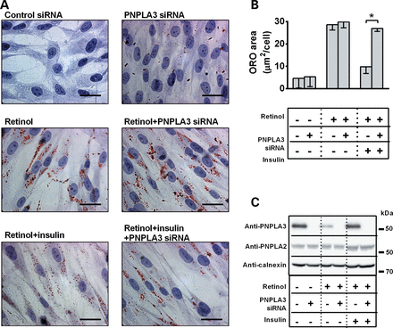 Insulin-mediated PNPLA3 upregulation reduces lipid droplet content in pHSCs. (A) Lipid droplet content visualized by ORO staining in pHSCs incubated w/o retinol-palmitic acid for 48 h, transfected with PNPLA3 or control siRNA and incubated w/o insulin for further 48 h. Scale bars: 10 µm. (B) ORO-stained area quantified by BioPix. *P < 0.05. (C) Immunoblot showing PNPLA3 and PNPLA2 expression in pHSCs under conditions described in (A).