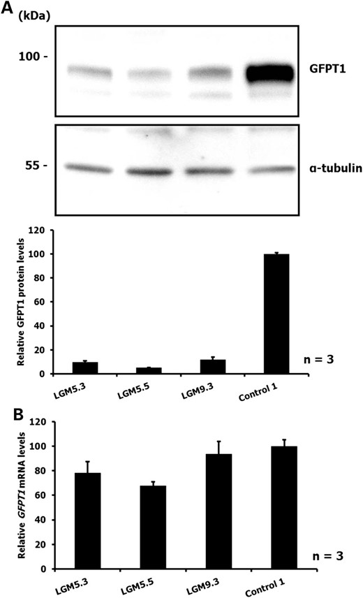 (A) Immunoblot detection of GFPT1 in myoblasts of patients with the GFPT1 mutation c.*22C>A and heteroallelic missense mutations (LGM5.3 and LGM5.5: p.M492T; LGM9.3: p.V199F). Control 1: healthy control individual. Upper panel: representative result from three independent experiments. Lower panel: The intensities of the bands were measured and GFPT1 expression was normalized to α-tubulin levels. Data are shown relative to the GFPT1 level of the control individual. (B) Levels of GFPT1 mRNA in myoblasts obtained from GFPT1 patients compound heterozygous with the c.*22C>A mutation (LGM5.3, LGM5.5 and LGM9.3; for missense mutations on the second allele, see (A)). Control 1: healthy control individual. Transcript levels were analysed by real-time qRT-PCR and normalized to histone hH4 levels. Data represent three independent experiments and are shown relative to the GFPT1 level of the control individual.