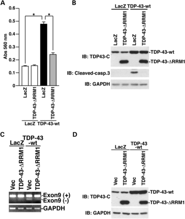 TDP-43-ΔRRM1 inhibits TDP-43-induced neuronal cell death and skipping activity of CFTR exon 9. (A and B) NSC34 cells, seeded on six-well plates at 1 × 105 cells/well, were co-infected with LacZ or TDP-43 adenovirus at a moi of 400 together with LacZ or TDP-43-ΔRRM1 adenovirus at a moi of 400. All samples were co-infected with Cre-recombinase virus at a moi of 40. Twenty-four hours after infection, media of cells were replaced with DMEM/N2 supplement. Twenty-four hours after the replacement of media, LDH release from cells was measured (A). *P < 0.05. The cell lysates were immunoblotted using the indicated antibodies (B). (C and D) COS7 cells transiently overexpressing TDP-43-wt by adenoviral infection at a moi of 100 together with TDP-43-ΔRRM1 by plasmid transfection were harvested 48 h after transfection and the prepared total RNA were used for CFTR exon 9 skipping assays (C). All samples were co-transfected with pSPL3-CFTR9-TG11T7 reporter plasmid and co-infected with Cre-recombinase virus at a moi of 40. The cell lysates were immunoblotted using the indicated antibodies (D).