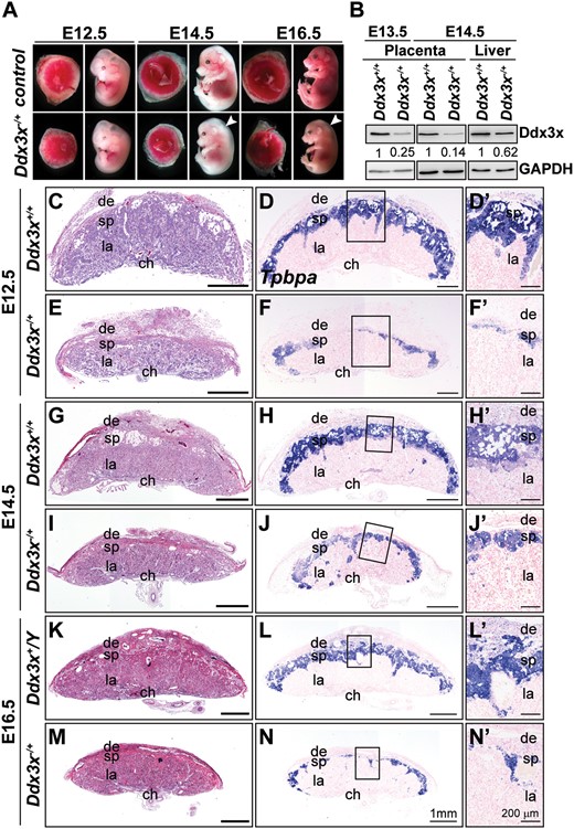 Targeted disruption of maternal Ddx3x allele causes placental defects and prenatal lethality in mice. (A) Whole-mount analysis of F2 Ddx3x−/+ mutant embryos and placentas. Representative images of wild-type littermates (Ddx3x+/+ and/or Ddx3x+/Y) and viable Ddx3x−/+ mutants at E12.5, E14.5, and E16.5. White arrowheads indicate whole body edema in Ddx3x−/+ mutants. (B) Ddx3x expression in placentas and livers from Ddx3x+/+ and Ddx3x−/+ embryos. Tissue extracts prepared from E13.5 and E14.5 Ddx3x+/+ littermates revealed the expected 72 kDa band, whereas Ddx3x expression levels in Ddx3x−/+ placentas were significantly reduced. GAPDH was used as the loading control. Relative Ddx3x protein levels were quantified using ImageJ software. (C−N’) Reduced thickness of spongiotrophoblast layers in mutant Ddx3x−/+ placentas. Hematoxylin and eosin (H&E)-stained midline placental sections from E12.5, E14.5, and E16.5 wild-type (C, G, K) and Ddx3x+/−(E, I, M) embryos. Placental size and spongiotrophoblast layer thickness are drastically reduced in the Ddx3x−/+ mutants compared with those of controls. RNA in situ hybridization analysis of a Tpbpa probe (blue) marks the spongiotrophoblast layer of placentas from wild-type (D, H, L) and Ddx3x−/+ mutants (F, J, N). A significant reduction in Tpbpa-expressing cells occurs in placentas from Ddx3x−/+ embryos. Higher magnification of boxed areas in D, F, H, J, L, and N are shown in D’, F’, H’, J’, L’, and N’, respectively. Nuclei were counterstained with nuclear fast red. ch, chorion; de, decidua; la, labyrinth; sp, spongiotrophoblast. Scale bars, 1 mm (C−N); 200 μm (D’−N’).