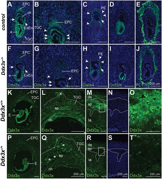 Paternally derived Ddx3x is preferentially inactivated in extraembryonic tissues of Ddx3x−/+ female embryos. Immunofluorescence analyses of Ddx3x, Gata4, Oct3/4, and PL1 expression in serial sections of E7.5 implantation sites. High Ddx3x levels were detected in embryos and extraembryonic tissues (EPC, chorion, extraembryonic endoderm, and parietal endoderm) in controls. Weak Ddx3x expression was observed in TGCs (A). Ddx3x levels were moderately reduced in Ddx3x−/+ embryo proper (F), whereas Ddx3x was significantly reduced in extraembryonic tissues of Ddx3x−/+ embryos compared with those of Ddx3x+/+ littermates (A). Higher magnification of E7.5 EPC areas in A and F are shown in (B) and (G), respectively. Gata4 expression was used to identify the visceral endoderm (arrows) and parietal endoderm (arrowhead) in control (C) and Ddx3x−/+ (H) embryos. Anti-Oct3/4 antibody specifically stained the epiblasts of control (D) and Ddx3x−/+ (I) embryos. PL1-positive trophoblast cells in Ddx3x−/+ implantation site (J) were less protrusive than those in littermate control (E). Nuclei were stained with DAPI (blue). Immunohistochemical analysis of Ddx3x in E8.5 implantation sites (K, L, P and Q) and E16.5 placentas (M−O and R−T) from Ddx3x+/+ and Ddx3x−/+ embryos. The expression of Ddx3x is relative higher in embryo than in the extraembryonic tissues (K). In Ddx3x−/+, the levels of Ddx3x in embryo was slightly lower than the littermate control, however, the protein was uniformly distributed in all embryonic cells (P). Ddx3x is moderately expressed in EPC, while weak expression was observed in TGCs in Ddx3x+/+ implantation site (K). In the Ddx3x−/+ extraembryonic tissues, the expression of Ddx3x was significantly reduced, specifically in EPC (P and Q). Higher magnification of EPC regions in K and P are shown in L and Q, respectively. Dotted lines demarcate the outer border of TGC layer. Asterisks indicate the autofluorescence from blood cells. At E16.5 placenta, Ddx3x expression was highest in spongiotrophoblast layer, albeit not at uniform levels in all cells. Expression levels of Ddx3x were very low, but detectable, in the decidua and labyrinth layer (M). Consistently, the expression of Ddx3x in the spongiotrophoblast layer was significantly reduced in Ddx3x−/+ placenta (R) compared with Ddx3x+/+ littermate (M). Dotted lines demarcate the boundary of spongiotrophoblast layer of the placenta. Boxed areas in M and R are shown at higher magnification in O and T, respectively. The nuclei were counterstained with DAPI (N and S). ch, chorion, de, decidua; E, embryo; EPC, ectoplacental cone; ExEn, extraembryonic endoderm; la, labyrinth; PE, parietal endoderm; sp, spongiotrophoblast; TGC, trophoblast giant cell. Scale bars, 200 μm (A−N, P−S); 100 μm (O, T).