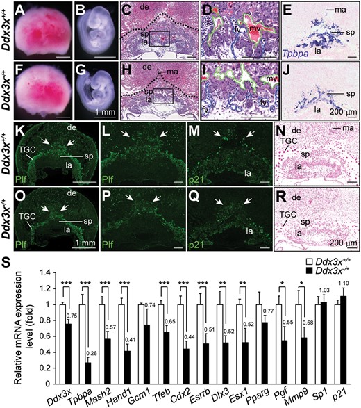 Loss of Ddx3x in Ddx3x−/+ extraembryonic tissues leads to abnormal placental development and marker gene expression. Representative images of placentas and embryos from E9.5 Ddx3x+/+ littermates and Ddx3x−/+ mutants. Placentas from Ddx3x+/+ littermate (A) and Ddx3x−/+ mutant (F) were similar in size, whereas the Ddx3x−/+ embryo (G) was slightly smaller than that of the littermate (B). H&E stained placental sections from E9.5 Ddx3x−/+ mutant (H) showed relatively fewer spongiotrophoblast cells than that in littermate control (C). Dotted lines demarcate the outer placental surface. Boxed areas in C and H are shown at higher magnification in D and I, respectively. Branching morphogenesis of the chorioallantoic interface was apparent in placenta from Ddx3x+/+ control (D). Fetal vessels (filled with nucleated embryonic erythrocytes, blue dashed lines) were juxtaposed with maternal blood vessels (filled with enucleated erythrocytes, green dashed lines). Fetal vessels remained in the chorioallantoic plate region of mutant Ddx3x−/+ placenta (I). Tpbpa-expressing cells localized almost exclusively to the spongiotrophoblast layer of Ddx3x+/+ littermate placenta (E). An apparent reduction in Tpbpa-expressing cells was observed in Ddx3x−/+ placenta (J). Characterization of trophoblast cells in E9.5 placentas. The populations of Plf-positive primary and secondary TGCs (indicated by white arrows) were decreased in Ddx3x−/+ placenta (O) than those in littermate control (K). The distribution of outer TGC layer in Ddx3x−/+ placenta (arrows, P) was less protrusive than those in littermate control (L). The expression of p21 was detected in all three trophoblast layers of Ddx3x+/+ placenta: the outer TGC layer, spongiotrophoblast and labyrinth layer (M). The p21-positive nuclei (arrows) in secondary TGCs surrounding the spongiotrophoblast layer in Ddx3x−/+ placenta were smaller, while the expression of p21 in labyrinth layer was not altered (Q). Feulgen-stained placental sections showed the size of the nuclei and the staining intensities of TGCs were reduced in Ddx3x−/+ placenta (R) compared with the Ddx3x+/+ placenta (N). (S) Quantitative RT-PCR analysis of Ddx3x and marker genes in placentas from E9.5 Ddx3x+/+ and Ddx3x−/+ embryos. n = 7 per group. Error bars indicate SEM; *P < 0.05, **P< 0.01, ***P < 0.005. de, decidua; fv, fetal vessel; la, labyrinth; ma, maternal artery; mv, maternal vessel; sp, spongiotrophoblast; TGC, trophoblast giant cell. Scale bars, 1 mm (A, B, F, G, K, O); 200 μm (C−E, H−J, L−N, P−R).