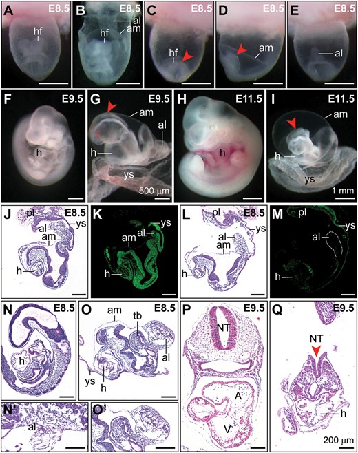 Developmental defects in Sox2-cre/+;Ddx3xflox/Y mutants. (A−I) Representative images of littermate controls and Sox2-cre/+;Ddx3xflox/Y mutants at E8.5, E9.5, and E11.5. Frontal view of the control embryo within the yolk sac (A) showed the normal appearance of the head region. In the early E8.5 control embryo (B) with the yolk sac partially dissected, the allantois was attached to the chorion. Abnormal headfolds (arrowheads) were observed in Sox2-cre/+;Ddx3xflox/Y mutants (C, frontal view; D, lateral view, anterior to the left). In Sox2-cre/+;Ddx3xflox/Y mutants (E, dorsal view), the allantois did not fuse to the chorion and appears as a bud. At E9.5, control embryo was dissected from the yolk sac and showed normal turned appearance (F). The Sox2-cre/+;Ddx3xflox/Y mutant displayed severe growth retardation, abnormal headfolds (arrowhead), and failure to turn (G). At E11.5, the allantois did not fuse to the chorion and appeared as an abnormal balloon-like shape in the Sox2-cre/+;Ddx3xflox/Y mutant (I). Defective neural tube closure (arrowhead) and strikingly disorganized posterior body were observed in the Sox2-cre/+;Ddx3xflox/Y mutant compared with those in the littermate control (H). H&E stained sagittal sections of E8.5 littermate control (J) and Sox2-cre/+;Ddx3xflox/Y mutant (L). Sox2-cre/+;Ddx3xflox/Y mutant exhibited a shorter allantois that had not expanded to make contact with the chorion. Immunohistochemical staining showed that Ddx3x protein was strongly localized in the embryo proper of the control (K), whereas very weak Ddx3x protein staining was observed in the Sox2-cre/+;Ddx3xflox/Y mutant (M). Histological sections of late-stage E8.5 littermate control (N) that had completed turning and established allantois contact with the chorion (N’). Sox2-cre/+;Ddx3xflox/Y mutant failed to undergo embryo turning, and displayed developmental delay with irregularly shaped tail bud and bulbous allantois (O). Higher magnification view of the allantois in O is shown in O’. H&E stained sections of E9.5 embryos revealed normal development in control embryo (P), whereas Sox2-cre/+;Ddx3xflox/Y mutant displayed growth retardation, defective neural tube closure (arrowhead), and cardiac malformation (Q). A, atrium; al, allantois; am, amnion; NT, neural tube; hf, headfold; h, heart; pl, placenta; tb, tail bud; V, ventricle; ys, yolk sac. Scale bars, 500 μm (A−G); 1 mm (H, I); 200 μm (J−Q).