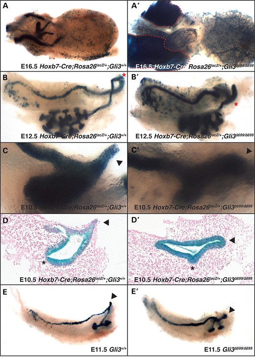 The presumptive ureter inserts into the bladder at E16.5 in Hoxb7-Cre;Rosa26lacZ/+;Gli3+/+ (A) control mice (visualized in blue). In contrast, the ureter ends blindly and fails to reach the bladder and is highly distended in Hoxb7-Cre;Rosa26lacZ;Gli3Δ699/Δ699 (A′) mutant mice (visualized in blue, ureter outlined in red). The origin of the ureteric bud is shifted cranially along the common nephric duct (B′, asterisk) at E12.5 in Hoxb7-Cre;Rosa26lacZ;Gli3Δ699/Δ699 embryos when it normally abuts the tip of the common nephric duct as seen in Hoxb7-Cre;Rosa26lacZ/+;Gli3+/+controls (B). At E10.5, the tip of the common nephric duct is pointed in Hoxb7-Cre;Rosa26lacZ/+;Gli3+/+ (C, arrowhead) control mice but round and misshapen in Hoxb7-Cre;Rosa26lacZ;Gli3Δ699/Δ699 mutants (C′, arrowhead). The morphology of the common nephric duct is demonstrated in control (D) and mutant (D′) mice. In a subset of Hoxb7-Cre;Rosa26lacZ;Gli3Δ699/Δ699 mutant mice (E′), a ‘Y’-shaped collecting system is observed with two distinct ureteric buds.
