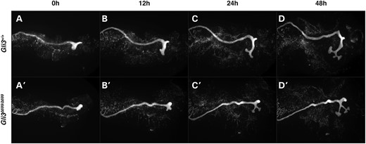 E10.5 tdTomato expressing fluorescent nephric ducts were imaged every 5 min over a 48 h window demonstrating abnormal ureteric budding and stalk elongation in Hoxb7-Cre;Rosa26tdTomato/+;Gli3Δ699/Δ699 mutants (A′–D′, Supplementary Material, Movie S2) when compared with Hoxb7-Cre;Rosa26tdTomato/+;Gli3+/+ controls (Supplementary Material, Movie S1).
