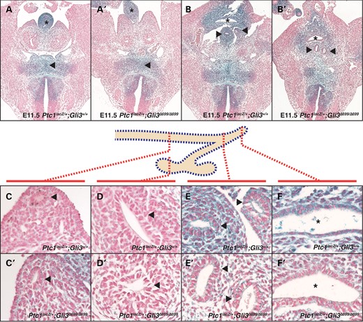 At E11.5, lacZ staining demonstrates the state of Hedgehog signaling in Gli3+/+;Ptc1lacZ/+ and Gli3Δ699/Δ699;Ptc1lacZ/+ transverse tissue sections. LacZ staining is detected in controls in the area surrounding the notochord (A, arrowhead), ventral gut tube (A, asterisk) and cloaca (B, asterisk). LacZ staining is reduced in Gli3Δ699/Δ699;Ptc1lacZ/+ mutant embryos (A′ and B′, arrowhead, asterisk). No lacZ staining is detected in control and mutant nephric ducts (C and C′, arrowheads) or ureteric buds (D and D′, arrowheads). Marked lacZ staining is detected in controls in the common nephric ducts (E, arrowheads), cloaca and vesicular mesenchyme (F, asterisk) that is reduced in mutants (E′, arrowheads, F′, asterisk).