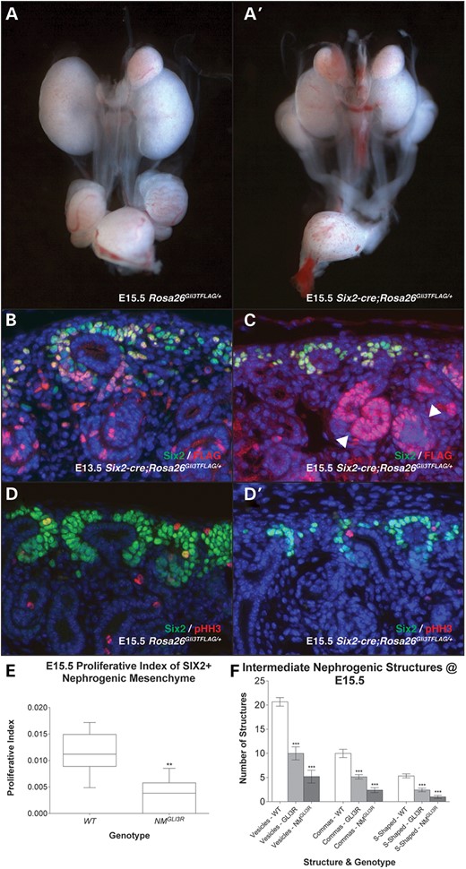 Six2-Cre;Rosa26Gli3TFLAG/+ mutant (A′) kidneys were hypoplastic at E15.5 when compared with Rosa26Gli3TFLAG/+controls (A). Immunofluorescence for SIX2 and FLAG demonstrate the degree of recombination at E13.5 (B) and at E15.5 (C) in Six2-Cre;Rosa26Gli3TFLAG/+ mutants. SIX2-positive nephrogenic mesenchyme caps were irregular and sparse in Six2-Cre;Rosa26Gli3TFLAG/+ mutants (C and D′) at E15.5 when compared with controls (D). FLAG-positive cells are found in nephrogenic structures (C, arrowheads). Proliferation was assessed at E15.5 by anti-pHH3 staining and found to be reduced by 69.4% (E). Renal vesicles, comma-shaped bodies and S-shaped bodies were reduced by 48.4, 51.4 and 45.6% in Gli3Δ699/Δ699 mutant kidneys and by 74.8, 76.0 and 81.2% in Six2-Cre;Rosa26Gli3TFLAG/+ mutant kidneys.