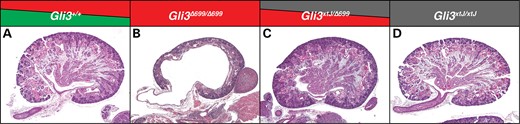 A single allele of Gli3Δ699 was replaced with a null Gli3xtJ allele in Gli3Δ699/Δ699 mutants. In contrast to Gli3Δ699/Δ699 mutant kidneys at E18.5 (B), Gli3Δ699/xtJ mutant kidneys (C) are phenotypically normal and resemble Gli3+/+ control kidneys (A). Gli3xtJ/xtJ kidneys are shown for comparison (D).