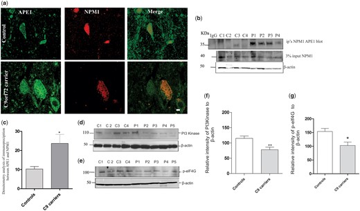 NPM1 co-precipitates more with APE1 in human C9orf72 patient spinal cord lysates compared to control patients (A) Immunohistochemistry of spinal cord tissues from human C9orf72 patients and control patients was performed using anti-NPM1 and anti-APE1 antibodies. Co-localization of APE1 and NPM1 in motor neurons of control and ALS patients was observed. (B) Human spinal cord lysates (100 μg) were subjected to immunoprecipitation using anti-NPM1 antibodies, followed by western blotting using anti-APE1 antibodies. Isotype-matched IgG antibodies were used as a control for immunoprecipitation. More APE1 was precipitated in C9orf72 lysates (P7-P10; Table 1) compared to control patients (C6-C10; Table 1). Inputs (3%) are also shown. Blots were stripped and reprobed with anti-β-actin antibodies as a loading control. Scale bar 10μm. (C) Densitometry quantification of blots in (B) revealed that significantly more NPM1 was precipitated in lysates from patients bearing the C9orf72 mutation compared to those from control patients (13.36 ± 4.923%, P < 0.05). Data are represented as mean ± SEM; *P < 0.05 versus controls by unpaired student’s-t test. A total of five C9orf72 and five control spinal cords lysates were examined, and each sample was blotted two times. (D,E) Human spinal cord homogenates (30µg) were subjected to western blotting using anti-PI3K and anti-p-elF4G antibodies. Blots were reprobed with anti-β-actin antibodies as a loading control. (F,G) Densitometry quantification of blots in (D,E) relative to β-actin revealed that the levels of PI3K and p-elf4G were significantly reduced in C9orf72 patients compared to controls (40% decrease; P < 0.05; 32.20% decrease; P < 0.001). A total of ten C9orf72 and ten control spinal cord lysates were examined. Data are represented as mean ± SEM; **P < 0.001, versus controls by unpaired student-t test.