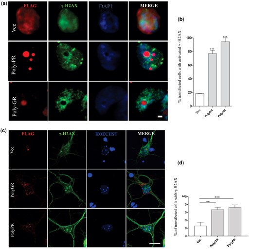 γ-H2AX foci accumulate in the nucleus of SH-SY5Y cells and primary cortical neurons expressing poly (GR)100 and poly (PR)100 (A) SH-SY5Y cells were transfected with either FLAG-tagged poly (GR)100, poly (PR)100 constructs or empty vector (PCMVIE) for 48 h. Immunocytochemistry using anti-γ-H2AX antibodies revealed that more cells formed nuclear γ-H2AX foci in cells expressing poly (GR)100 or poly (PR)100 compared to cells transfected with vector only. Scale bar, 10μm applied to all fields. Cells with accumulation of more than 5 foci of γ-H2AX in the nucleus were counted as positive. (B) Quantification of transfected cells in (A) revealed that significantly more cells with nuclear γ-H2AX foci were present in transfected cells expressing poly (GR)100 or poly (PR)100 compared to control cells transfected with empty vector only (Vec). Data are represented as mean ± SEM; ***P < 0.0001, versus untransfected cells by one-way ANOVA followed by Tukey’s post-test. 50 cells were scored in each group from two different experiments. (C) Primary cortical neuronal cultures were prepared from mouse C57BL/6 E16 brains. Neurons were transfected with either FLAG-tagged poly (GR)100, poly (PR)100 constructs or empty vector (PCMVIE), and fixed with 4% paraformaldehyde after 24 h. Immunocytochemistry was performed using γ-H2AX and anti-FLAG antibodies, and nuclei were counterstained with Hoechst 33342. Scale bar 10μm. (D) Quantification of the percentage of cells with activated γ-H2AX revealed that significantly more cells with nuclear γ-H2AX foci were present in primary neurons expressing poly (GR)100 or poly (PR)100 compared to control neurons transfected with empty vector only (Vec). Data are represented as a mean +/- SEM; γ-H2AX activation: ***P < 0.001, **P < 0.01; versus control cells (Vec) by one-way ANOVA followed by Sidak’s post-test. At least 20 cells in each group were included from three different experiments.