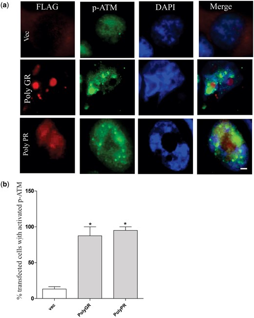 More SH-SY5Y cells expressing poly (GR)100 and poly (PR)100 display phosphorylated ATM. (A) SH-SY5Y cells were transfected with either FLAG-tagged poly (GR)100, poly (PR)100 or empty vector (PCMVIE) for 48 h. Immunocytochemistry using anti-p-ATM antibodies revealed that p-ATM was activated in cells expressing poly (GR)100 or poly (PR) 100. Scale bar, 10μm applied to all fields. (B) Quantification analysis of transfected cells in (A) revealed that significantly more cells with p-ATM were present in cells expressing poly (GR)100 or poly (PR)100 compared to cells transfected with empty vector only (Vec). Data are represented as mean ± SEM; *P < 0.05, versus untransfected cells by one-way ANOVA followed by Tukey’s post-test. 50 cells were scored from two different experiments.