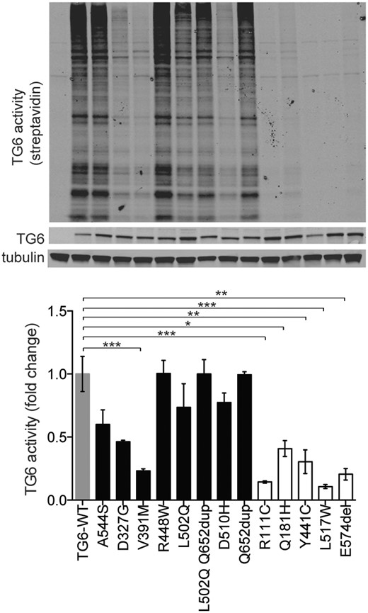 Mutations in TG6 alter its enzymatic activity. Immunoblot (top) and analysis of enzymatic activity (bottom) in transiently transfected HEK293T cells showed a significant reduction of transamidase activity of TG6-V391M, TG6-R111C, TG6-Q181H, TG6-Y441C, TG6-L517W and TG6-E574del. TG6 activity was revealed with streptavidin conjugated to a fluorophore with emission at 800 nm and it is shown as fold change where TG6-WT activity was set as 1. Graph, mean±SEM, *P <0.05; **P <0.01; ***P <0.001, 1-way ANOVA with Tukey’s post hoc test.