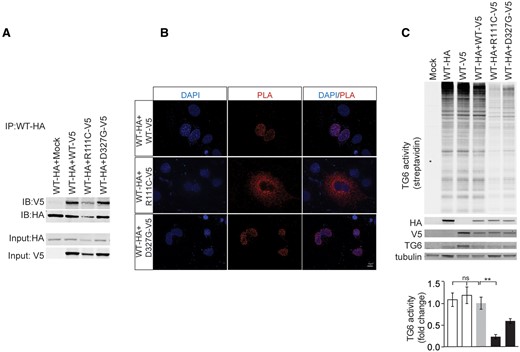 TG6 mutants interact with and affect the function of TG6-WT. (A) Immunoprecipitation assay in HEK293T cells transiently transfected with vectors expressing HA- and V5-tagged TG6-WT, TG6-R111C, TG6-D327G revealed that TG6 mutants form a complex with TG6-WT. Shown is one experiment representative of three. IP, immunoprecipitation with HA antibody-conjugated beads. IB, immunoblot with anti-HA and V5 antibodies. (B) The interaction between HA-tagged TG6-WT with V5-tagged TG6-WT or V5-tagged mutants was analyzed in intact cells by the PLA (red). The red dots represents areas of close proximity of HA and V5 epitopes. Nuclei were revealed with DAPI. Shown are representative images from three independent experiments. Bar, 10 µm. (C) Functional analysis of HA-tagged TG6-WT co-expressed with either V5-tagged TG6-WT or V5-tagged TG6 mutants in HEK293T cells revealed that TG6-R111C significantly reduce TG6-WT activity. The activity of co-expressed HA-tagged TG6-WT and V5-tagged TG6-WT was set as 1. Graph, mean±SEM, n =3; **P<0.01, 1-way ANOVA with Tukey’s post hoc test.