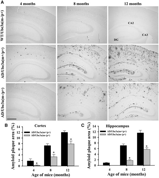 Decreased Aβ plaques load in the brain of Ube3a-maternal deficient AD mice. (A) Representative immunohistochemical staining of Aβ plaques in cortical and hippocampal regions as detected by 6E10 antibody. Brain sections obtained from wild type, AD and Ube3a-maternal deficient AD mice at different ages were placed on same slides and subjected to immunostaining. Brain sections from at least four different mice in each group were analysed. Scale bar, 500 µm. Quantitative analysis of 6E10-positive Aβ plaques area as a percentage of total areas in the cortical (B) and hippocampal (C) region using ImageJ. Values are mean ± SD of 4 animals/genotype/age group. *P < 0.001 compared with AD group (one-way ANOVA).