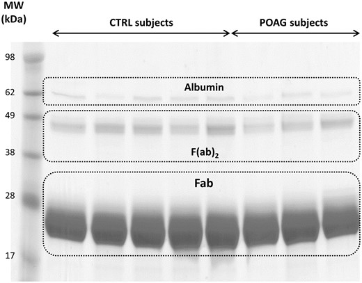 Exemplary 1-D SDS PAGE of the purified Fab fragments from 5 controls subjects and 4 POAG patients. The protein bands around 28 kDa represent the purified Fab fragments. Protein bands around 49 kDa show non-reduced F(ab)2 fragments and protein bands around 62 kDa contain traces of albumin. Each sample lane contains a total protein amount of 20 µg.