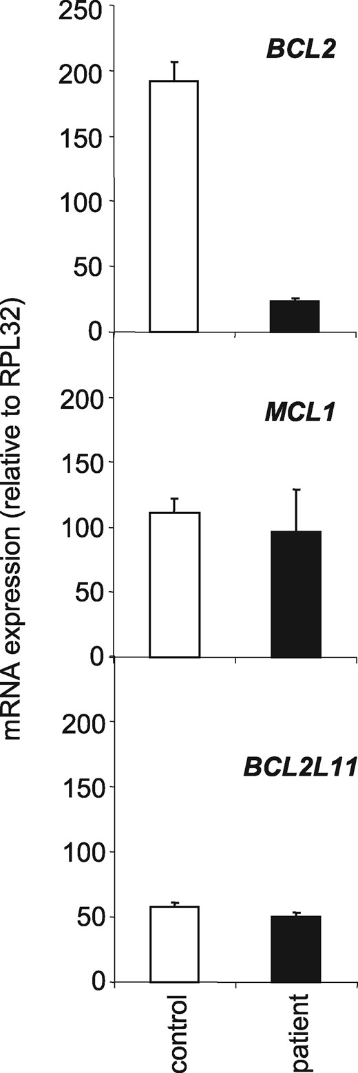 BCL2 mRNA and not MCL1 and BCL2L11 mRNAs decrease in patient T lymphocytes. RT-qPCR analysis of BCL2, MCL1 and BCL2L11 mRNA expression in peripheral blood CD3+ T cells from male control and the patient after one night of culture. Normalizer, RPL32 gene.