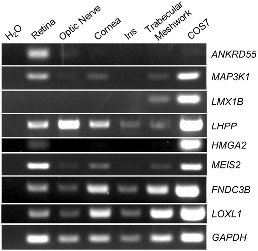 Expression of positional candidate genes at novel primary open-angle glaucoma (POAG)-associated loci in ocular tissues. Expression of the positional candidate genes (ANKRD55, MAP3K1, LMX1B, LHPP, HMGA2, MEIS2) at five novel POAG-associated loci in different parts of the monkey eye. Two loci (FNDC3B, LOXL1) were used as positive controls because the expression of these genes was confirmed in the retina and the trabecular meshwork. Lysates from the COS-7 cell line were used as controls. The internal control gene was GAPDH.