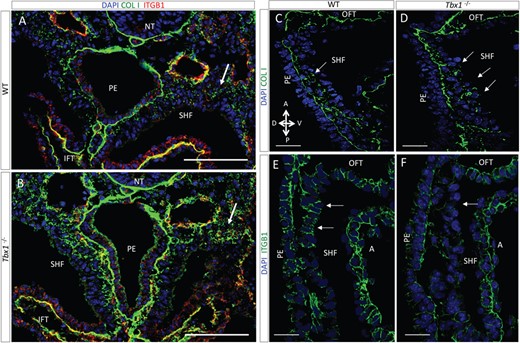 Collagen I and integrin β1 are altered in Tbx1 mutants (A,B) Transverse sections of E9.5 embryos showing the distribution of COLI in the SpM. Arrows indicate COLI accumulation in the Tbx1−/− mutant (scale bar, 100 μm). (C,D) Confocal images of COLI immunostaining at SHF level of WT (C) and Tbx1−/− embryos (D) (sagittal sections, E9.5). In the WT, COLI forms a rudimentary and discontinuous basal lamina, while in Tbx1−/− embryos, its distribution is abnormal, showing an accumulation between eSHF cells (see arrows; scale bar, 40 μm). (E,F) ITGB1 immunostaining of E9.5 WT and Tbx1−/− embryos. In the WT embryo, the signal is present in the anterior SHF and is not detectable in Tbx1−/− embryo (see arrows; scale bar, 20 μm). NT, neural tube; IFT, inflow tract; PE, pharyngeal endoderm; A, anterior; P, posterior; V, ventral; D, dorsal.