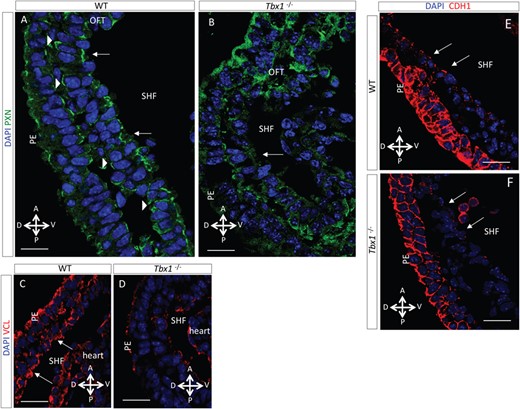 TBX1 regulates FA and cell-adhesion proteins in the eSHF. (A,B) Immunofluorescence on sagittal sections of E9.5 WT and Tbx1−/− embryos, showing the distribution of PXN. (A) In the WT embryo PXN accumulates predominantly at the apical surface and cell junctions (arrows), forming a nearly continuous line in the apical membrane of eSHF cells. PXN staining was also found in the basal domain (arrowheads) of eSHF cells. In the endoderm PXN staining marks both apical and basal domains. (B) In the Tbx1−/− embryo, the PXN pattern in the eSHF cells is completely abolished (scale bar, 20 μm). (C,D) Immunostaining of VCL on sagittal sections of an E9.5 WT and Tbx1−/− embryos. (C) In the WT embryo, VCL displays an apical domain in the eSHF cells (arrows), similarly to the PXN domain. (D) In the Tbx1−/− embryo, this characteristic pattern of VCL is severely affected and intensity of staining is reduced (scale bar, 30 μm). (E,F) In a WT embryo, CDH1 is observed on the apical-lateral domains of the eSHF monolayer, predominantly in the anterior region of the SHF (arrows). In the Tbx1−/− embryo, the CDH1 signal is reduced or nearly abolished in the posterior-lateral regions of SHF (scale bar, 15 μm). PE, pharyngeal endoderm; A, anterior; P, posterior; V, ventral; D, dorsal.