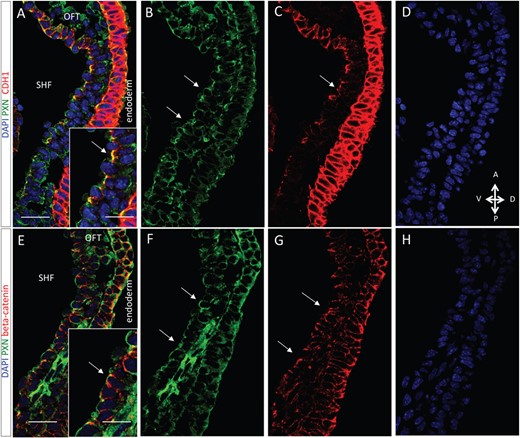 Apical-junctional co-localization of PXN and CDH1 in the eSHF. (A–D) Immunofluorescence of sagittal sections of E9.5 WT embryos showing the distribution of PXN and the cell–cell junction proteins CDH1 and beta-catenin. PXN accumulates in the apical-lateral domain of eSHF cells and partially overlaps with CDH1-positive junctions (arrow) or (E–H) with beta-catenin-positive junctions (arrows; scale bars, 40 μm). High-magnification views are boxed in A and E (scale bar, 10 μm). A, anterior; P, posterior; V, ventral; D, dorsal.