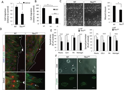 TBX1 regulates cell migration and polarity. (A,B) siRNAs-transfected C2C12 cells (A) or MEF (B) were plated on COLI-coated Transwell filters containing 10% FBS in the bottom well. The migration values are the means ± s.d. of three experiments performed in triplicate, normalized to the number of migrating cells in the absence of FBS, shown as fold change relative to control (*P < 0.05). (C) Left panel: phase contrast images taken from a time-lapse series at 16 h after scratch wounding of control (NT) and Tbx1KD cells (scale bar, 100 μm). Right panel: scratch wound area showed as percentage of the initial wound area as determined using ImageJ software. The values are the means ± s.d. of three independent experiments (*P < 0.05). (D) Images of immunofluorescence with anti-Giantin and staining with phalloidin (F-actin; upper panels) and respective high-magnification views (lower panels); arrowheads indicate lamellipodia structures. Cells were transfected with the indicated siRNA, and after 42 h, a wound was made using a pipette tip and cells were allowed to migrate and polarize for ~5 h, then they were fixed and processed for immunofluorescence; arrows indicate the Giantin signal (scale bar, 50 μm). (E) Quantification of cell area (left panel) and cell perimeter (right panel) of siRNAs-transfected C2C12 cells after seeding on plastic uncoated or coated with COLI or FN for 30 min (mean ± s.d. from four different experiments with > 300 cells per condition). NT, non-targeting control siRNA. Cell area and perimeter were determined by using ImageJ software. Values are shown relative to NT (***P < 0.001; **P < 0.01). (F) Representative phase-contrast images of cells plated on COLI at sparse density for 20 min (top panels) or Phalloidin staining of spread cells after 30 min on COLI (bottom panels); white arrow represents lamella (scale bar, 20 μm).