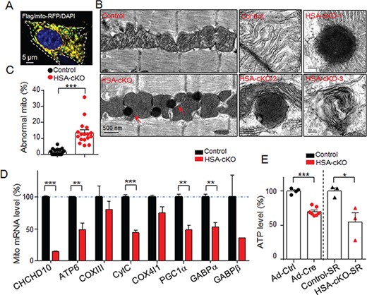 CHCHD10 regulates mitochondria structure and ATP production. (A) Immunostaining of Flag-CHCHD10 in C2C12 cells. Green: Flag-CHCHD10; Red: Mito-RFP; Blue: DAPI. (B) EM analysis of mitochondria in control and HSA-CHCHD10−/− muscles (P60). The red arrows indicate the high-density round vesicles in the mutant. (C) Quantitative results in B; t-test; ***P < 0.001. (D) mRNA expression of mitochondria-related genes in two genotypes. Note that most of the mitochondria-related gene expression is reduced in the mutant. Three independent experiments were performed; t-test; **P < 0.01; ***P < 0.001. (E) Reduction of ATP levels in CHCHD10-ablated primary myotubes (Ad-Cre virus infected) and synaptic regions of muscles in HSA-CHCHD10−/− mice. At least three independent experiments were performed; t-test; *P < 0.05; ***P < 0.001. SR, synaptic region.