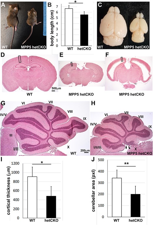 Mpp5 heterozygous CKO mice are smaller and have a reduced number of neurons. (A–C) At P21, body length and brain size were measured in Mpp5 het CKO mice and WT littermate controls (B, −17%, P = 0.012). (D–F) Histology with hematoxylin and eosin shows two microcephaly phenotypes—with and without ventriculomegaly. (G, H) Histology of cerebellum of WT and Mpp5 het CKO comparing size and lobe formation at P21. Arrows indicate the absence of molecular layer in the lobe X in Mpp5 het CKO. (I) Cortical thickness of Mpp5 het CKO compared with that of WT (−47%, P = 0.000002). (J) Comparison of cerebellar area between Mpp5 het CKO and WT (−42%, P = 0.0001). Data are presented as mean ± SEM. WT, n = 5; Mpp5 het CKO, n = 5.