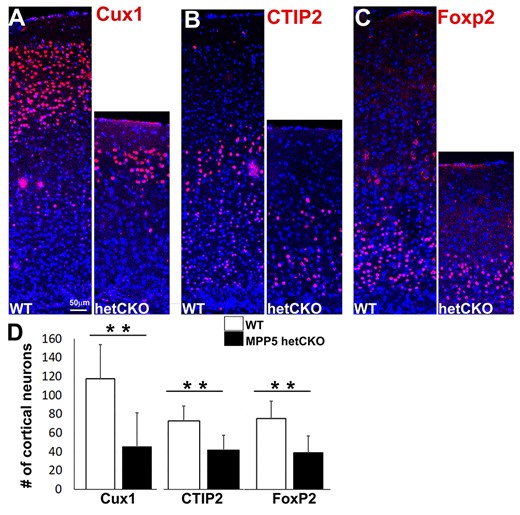 Mpp5 heterozygous CKO mice have a reduced number of neurons. (A–C) Immunostaining of cortical layer-specific neurons (Cux1+, layers 2–4, A; CTIP2+, layer 5, B; FoxP2+, layer 6, C) is shown in Mpp5 het CKO and WT control at P21 (D). The number of layer-specific neurons is compared between Mpp5 het CKO and WT (Cux1+ neurons, −61%, P = 0.0001; CTIP2 + neurons, −42%, P = 0.0001; FoxP2+ neurons, −49%, P = 0.0002). Data are presented as mean ± SEM. WT, n = 5; Mpp5 het CKO, n = 5.