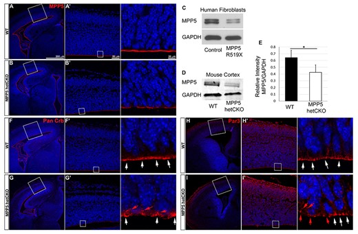 Mpp5 reduction decreases apical localization of apical polarity complex proteins in Mpp5 het CKO at E14.5. (A–B′) Representative image of Mpp5 immunostaining in WT and Mpp5 het CKO cerebral cortex at E14.5. (C) Western blot showing Mpp5 protein levels in fibroblasts derived from patient #1 and normal control. (D, E) Western blot and quantification of Mpp5 protein in Mpp5 het CKO and WT cortical lysates at E14.5 (E, −35%, P = 0.005). (F–I′) Representative images of apical polarity complex protein staining in developing cortex (Pan-Crb, F–G′; Par3, H–I′). White arrows indicate these proteins at the apical surface; red arrows indicate basally shifted ones. Data are presented as mean ± SEM. WT, n = 4; Mpp5 het cKO, n = 4.