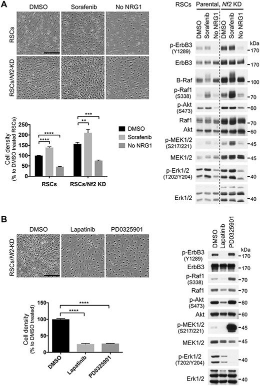 Merlin-deficient RSCs depend on the Ras–Erk pathway activity for proliferation. (A) RSCs and merlin-KD RSCs were grown to near confluence, then treated with 2 μm sorafenib or cultured in the absence of exogenous NRG1 for 12 days and directly lysed on dish with 2× SDS sample buffer for immunoblotting. Photos shown were at 9 days of treatment. Note that the lysates were not fully normalized for loading; both Akt and Erk1/2 can serve as loading control. (B) Merlin-KD RSCs were grown to near confluence and then treated with 0.5 μm lapatinib or 1 μm PD0325901 for 7 days. Media (with the inhibitors) were changed every 3 days, and after photography on the last day, cells were lysed for immunoblotting as described above. Cell number was counted from at least three representative regions, normalized to the respective controls and represented as mean ± SD. **P ≤ 0.01, ***P ≤ 0.001, ****P ≤ 0.0001; ordinary one-way analysis of variance followed by Dunnett’s multiple comparison test. Scale bars, 250 μm. Representative results of at least two independent experiments are shown for each panel.