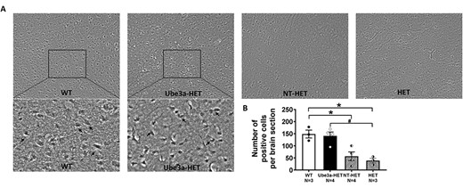Immunohistochemical analysis of UBE3A expression in cortex of the mouse brain. Six weeks post-transplant in adult mice, subjects were assessed for UBE3A expression using DAB as a chromogen. (A) Immunohistochemical images showing expression of UBE3A in the mouse cortex of non-transplanted Ube3a wild type IL2rg−/y (WT) mice, those transplanted with Ube3a vector transduced (Ube3a-HET) human CD34+ HSPC, those transplanted with NT human CD34+ HSPC (NT-HET), and non-transplanted HET mice (HET). (B) A significant increase in the UBE3A positive cells, similar to the WT level, was observed in transplanted Ube3a-HET compared with NT-HET and HET when treated as adults. Data are expressed as mean ± SEM. *P < 0.05 indicates when the HET and NT-HET groups differ from the control WT group. #P < 0.05 indicates when the Ube3a-HET group differs from HET group.