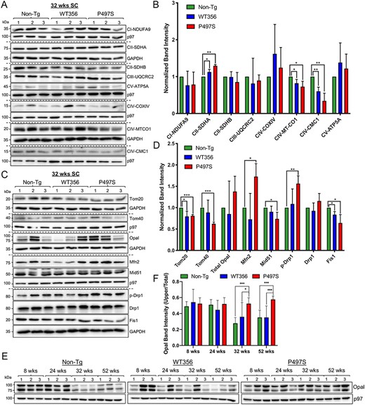 Mitochondrial protein changes in the P497S UBQLN2 mouse model of ALS/FTD. (A) Immunoblots of SC lysates from three independent mice for the three genotypes probed for mitochondrial electron transport chain proteins. (B) Quantification of the blots shown in A. *P < 0.05, **P < 0.01. (C) Immunoblots of SC lysates from 32-week-old animals probed for mitochondrial dynamics and import proteins. (D) Quantification of the blots shown in C. *P < 0.05, **P < 0.01, ***P < 0.001. (E) Immunoblots of SC lysates from mice of different ages and genotypes probed for Opa1. (F) Quantification of uncleaved Opa1 (100 kDa) relative to total Opa1 levels. *P < 0.05, ***P < 0.001.