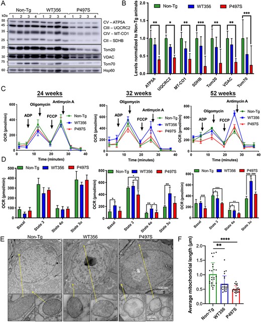 Structural and functional mitochondrial defects in the SC of P497S animals. (A) Immunoblots of equal protein lysates of mitochondria purified from the SC from four 52-week-old animals for the three genotypes probed for the proteins shown. (B) Quantification of the blots shown in A. *P < 0.05, **P < 0.01, ***P < 0.001. (C) Seahorse mitochondria respiration assays of freshly isolated mitochondria from the lumbar SC of mice from the three genotypes at 24, 32 and 52 weeks of age; oxygen consumption rate (OCR) curves are shown. n = 3–5. (D) Bar charts depict basal, State 3 (ADP-stimulated), State 4o (proton leak) and State 3u (maximal) respiration rates from traces shown in C. *P < 0.05, **P < 0.01, ***P < 0.001. (E) TEM images of the cell body regions of MN in the SC of 52-week-old mice for the three genotypes. Also shown are the magnified images of particular mitochondria in the MN (arrows). Scale bars for representative images, 500 and 100 nm for zoomed in mitochondria. (F) Average mitochondria length (μm) in SC motor neurons. **P < 0.01, ****P < 0.0001.