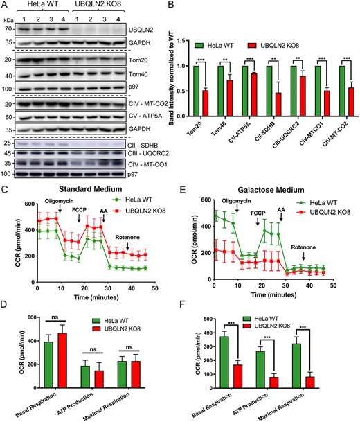 Inactivation of UBQLN2 expression in cells recapitulates the mitochondrial deficits seen in P497S animals. (A) Immunoblots of four independent lysates from parental HeLa WT and CRISPR/cas9 UBQLN2 KO8 lines probed for the indicated mitochondrial import and OXPHOS proteins. (B) Quantification of the blots shown in A. **P < 0.01, ***P < 0.001. (C) OCR curves depicting respiration rates of HeLa WT and UBQLN2 KO8 cell lines grown in standard DMEM media supplemented with glucose. (D) Bar chart of basal, ATP (oligomycin-sensitive) and maximal respiration. n = 4, ns, not significant. (E) OCR curves of HeLa WT and UBQLN2 KO8 lines grown in oxidative DMEM media supplemented with galactose. (F) Bar chart of basal, ATP (oligomycin-sensitive) and maximal respiration. n = 4, ***P < 0.001.