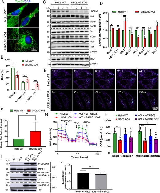 Alterations in mitochondria proteins, structure, function and dynamics in UBQLN2 KO cells and rescue of the functional deficits by reexpression of WT UBQLN2, but not by mutant P497S UBQLN2 proteins. (A) Parental HeLa WT and UBQLN2 KO8 lines stained with Tom20 to decorate mitochondria. Scale bar, 10 μm. (B) Quantification of the mitochondria network morphology of WT and KO8 cells into the percentage with tubular (>80% elongated mitochondria), intermediate (>50% short rod-like mitochondria) or fragmented (>50% fragmented mitochondria) mitochondria. n = 5, 50 cells per group. (C) Immunoblots of four independent lysates from WT and KO8 cultures probed for proteins shown. (D) Quantification of mitochondrial dynamic proteins shown in C. *P < 0.05, **P < 0.01, ***P < 0.001. (E) Time course images showing the extent of dissipation of GFP fluorescence in two focally activated regions in WT and KO8 cells expressing the mito-PAGFP reporter. (F) Quantification of the time of first fusion from the assay shown in E. n = 12, **P < 0.01. (G) OCR curves depicting parental HeLa WT and UBQLN2 KO8 cultures transfected with empty vector control, HA-tagged WT UBQLN2 or HA-tagged P497S UBQLN2 grown in oxidative DMEM media supplemented with galactose. (H) Quantification of basal and maximal respiration are shown for traces in G. n = 5, *P < 0.05, **P < 0.01, ***P < 0.001. (I) Immunoblots to show expression of the HA-tagged UBQLN2 constructs for the three separate experiments shown in G and H. (J) Quantification of HA-tagged WT and P497S mutant UBQLN2 proteins shown in I.