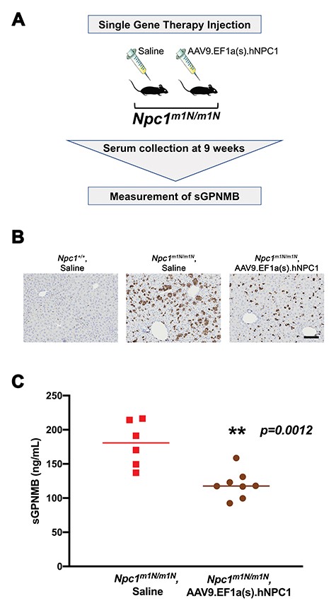 Reduced sGPNMB levels are present in Npc1m1N/m1N mutant mice that received AAV9.EF1a(s).hNPC1 gene therapy treatment. (A) Experimental design. Mice received a single injection of saline or AAV9.EF1a(s).hNPC1 at weaning, and plasma was collected at 9 weeks of age. (B) CD68 staining of liver sections demonstrated that the increased foam cells characteristic of Npc1m1N/m1N mutant mice (middle panel, saline-treated) are reduced by gene therapy treatment (right panel). Saline-treated Npc1+/+ controls are shown for comparison. Scale bar = 100 μm. (C) Mice receiving gene therapy exhibited significantly lower sGPNMB levels at 9 weeks of age in comparison to age-matched, saline-injected Npc1m1N/m1N mutant mice (P = 0.012, t-test).