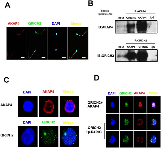Co-localization and interaction at the molecular level of AKAP4 and QRICH2 in human sperm flagella. (A) AKAP4 and QRICH2 were observed co-localized in human sperm flagella by immunofluorescence staining (Red, AKAP4; Green, QRICH2; Blue, DAPI. Scale bars, 20 μm). (B) The interactions between AKAP4 and QRICH2 in human spermatozoa were detected by Co-IP in vivo. (C and D) The distribution of AKAP4 and QRICH2 by immunofluorescence staining in HEK-293T cells (Red, AKAP4; Green, QRICH2; Blue, DAPI).