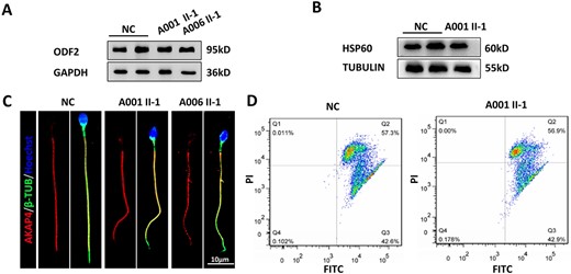 Structural characteristics of sperm flagella and the presence of intact mitochondrial sheath function in sperm from TEKT3-deficient patients. (A and B) Western immunoblotting was used to detect ODF2 and HSP60 in spermatozoa from fertile controls and the two probands. (C) Immunofluorescent staining was used to detect AKAP4 levels in spermatozoa. (D) MMP was determined by flow cytometry using JC-1, with FL1 and FL2 used to capture the FITC and PI signals, respectively.